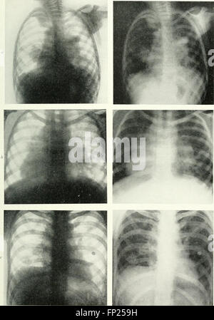 Röntgen, Röntgen-Therapeutika und Radium-Therapie (1915) Stockfoto