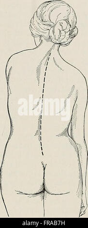Chirurgische Behandlung; eine praktische Abhandlung über die Therapie von chirurgischen Erkrankungen für die Verwendung von Praktiker und Studenten der Chirurgie (1920)