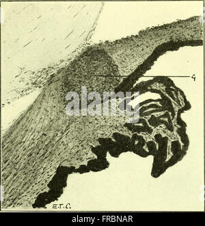 Diese 1911 vorliegende Ressource über Pathologie und Bakteriologie umfasst die Erforschung von Krankheiten und Mikroorganismen und betont die Rolle von Bakterien für die menschliche Gesundheit und Krankheit. Sie enthält detaillierte Informationen zu verschiedenen Krankheitserregern und Diagnosemethoden. Stockfoto