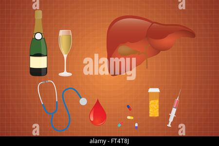 Zirrhose Illustration mit Leber Medizin Alkohol als die eigentliche Ursache Stock Vektor