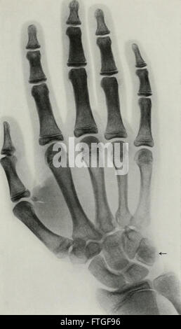 Lebendige Anatomie und Pathologie; die Diagnose von Krankheiten in den ersten Lebensjahren durch die Röntgen-Methode (1910)