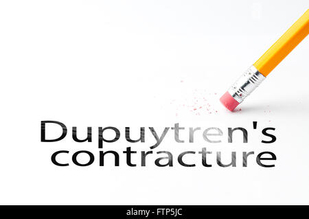 Bleistift mit Radiergummi Stockfoto