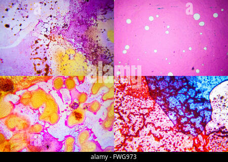 Mikroskopische Aufnahmen von Hautgewebe. Stockfoto