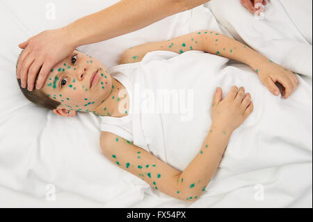 kranke Kind im Bett hat das Virus auf Haut, Mutters Hand berührt die Stirn Stockfoto