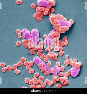Vaccinia-Virus-Partikel und Bakterien. Farbige scanning Electron Schliffbild (SEM) der Vaccinia-Virus-Partikel (rot). Im Gegensatz zu den meisten Viren repliziert "Vaccinia" in der Zelle Zytoplasma, anstatt den Kern. "Vaccinia" gehört zu den Orthopoxviren. Es bewirkt, dass Kuhpocken, eine Krankheit von Vieh und Mensch, dass produziert Hautläsionen. Es wurde zuerst von Jenner 1796 verwendet, gegen die Pocken, eine Verwandte aber mehr tödliche Krankheiten zu impfen. Es gibt etwa zehnmal so viele Bakterienzellen in der menschlichen Flora gibt es menschliche Zellen im Körper, mit der größten Zahl der menschlichen flora Stockfoto