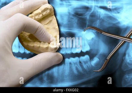 Zahnarzt über Röntgen dental Scan molare Zähne zeigen Stockfoto