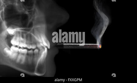 x-ray Röntgen Rauchen Zigarette beleuchtet Stockfoto
