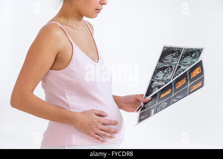 SCHWANGERE FRAU, SONOGRAPHIE Stockfoto