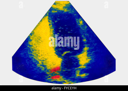 FÖTUS-ULTRASCHALL Stockfoto