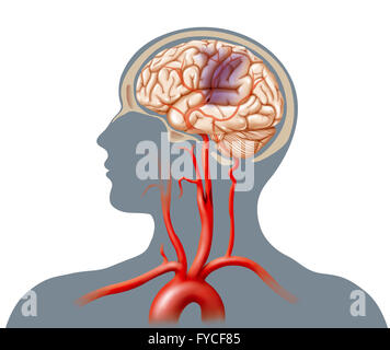 APOPLEXIE Stockfoto