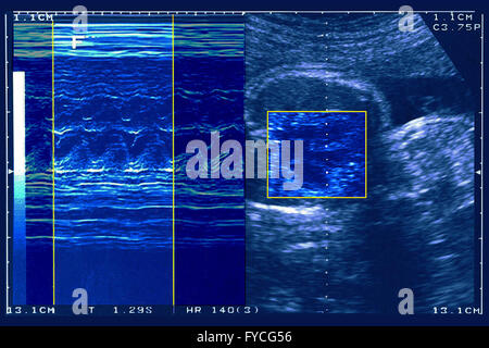 FÖTUS-ULTRASCHALL Stockfoto