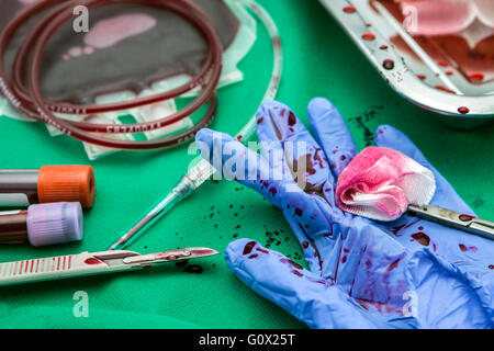 Einheit von Konzentrat roter Blutkörperchen, Transplantation des oberen Extremität in einem OP-Raum Stockfoto