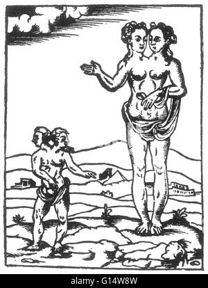 Holzschnitt von das "doppelte Monster Rhodiginus" und der Lycosthenes aus Des Monstres et Prodiges von Ambroise Paré, 1573. Siamesische Zwillinge sind eineiige Zwillinge mit ihrem Körper verbunden zu einem bestimmten Zeitpunkt und mit unterschiedlichem Grad der restliche Doppelarbeit geboren, Stockfoto