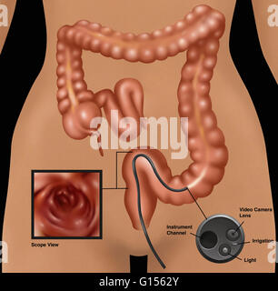 Eine Ansicht von ventral der Dickdarm und Dickdarms mit einem flexiblen Bereich im Dickdarm Sigma gezeigt. Stockfoto