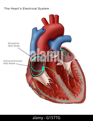 Abbildung zeigt das Herz Elektrik. Der Sinusknoten und Atrioventricular Knoten sind kommentiert. Der sinoatrial (SA)-Knoten (dicken grünen Oval oben links) besteht aus self-excitatory Muskelzellen, die rhythmisch auf rund 70 Vertrag Stockfoto