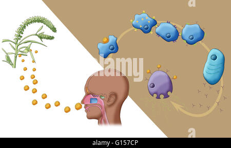 Darstellung, die die allergische Reaktion auf Ragweed. Stockfoto