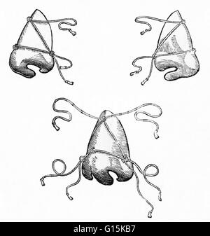 Masken, eine Nase nach einer Operation festzuhalten.  Illustration aus Gaspare Tagliacozzis Buch über plastische Chirurgie, De Curtorum Chirurgia pro Institionem (1597). Tagliacozzi (1547-1599) war eine italienische plastischen Chirurgen.  Zwar rekonstruktive Chirurgie hatte Stockfoto