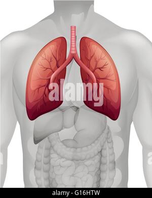 Lunge-Krebs-Diagramm in menschliche Abbildung Stock Vektor