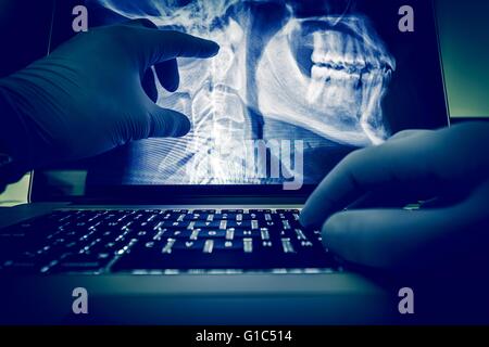 Arzt Untersuchung Wirbelsäule und Kopf X-Ray Scannen Bilder auf seinem Laptopcomputer. Medizinische Anwendung für Röntgen-Darstellung und Prüfung. Stockfoto