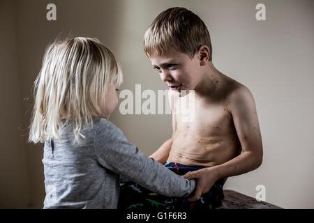 -MODELL VERÖFFENTLICHT. Junge mit Windpocken mit seiner Schwester. Stockfoto