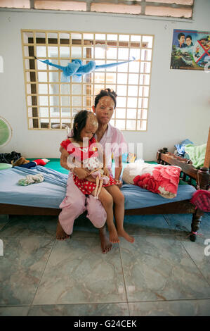 Sauren Gewalt Überlebenden Chheav Chenda und ihre Tochter Bun Cheata bei kambodschanischen Säure Überlebenden Charity in Phnom Penh, Kambodscha. Stockfoto