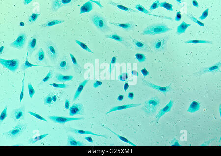 PC-3 menschlichen Prostatakrebszellen, befleckt mit Coomassie Blau, unter differen Interferenz-Kontrast-Mikroskop. Stockfoto