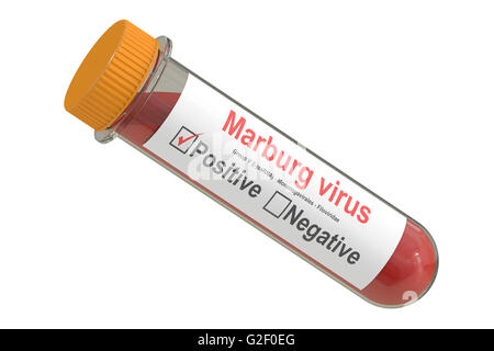 Reagenzglas mit Blut Probe positiv Marburg-Virus, 3D rendering Stockfoto