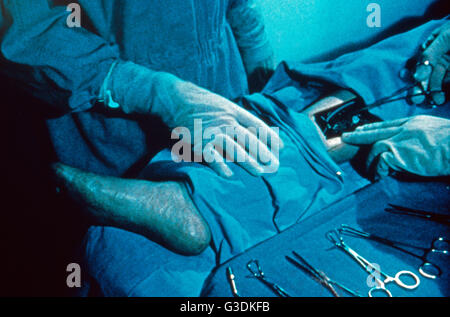 Der sechs Millionen Dollar Mann, auch bekannt als: Der Sechs Millionen Dollar Mann, Fernsehserie, USA 1974-1978, Szenenfoto Bionische Operation Stockfoto