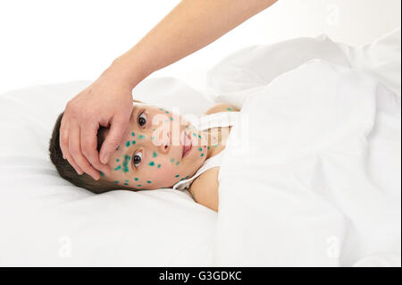 kranke Kind im Bett der Virus Windpocken auf Haut hat, die Hand der Mutter berührt die Stirn Stockfoto