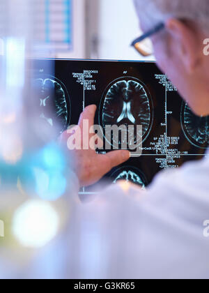 Radiologe Bewertung CT Gehirn-scan Stockfoto