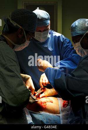 Ein generisches Stockfoto einer Operation, die im Queen Elizabeth Hospaital, Birmingham, stattfindet. Stockfoto