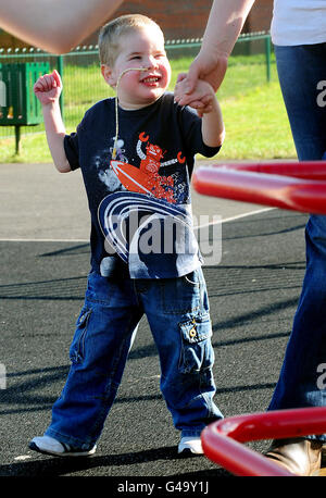 Mason Lewis zu Hause in Atherstone, Warwickshire. Der vierjährige Junge ist zur kleinsten Person in Großbritannien geworden, die eine erfolgreiche Lungentransplantation hat. Stockfoto