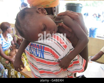 Schwer erkrantes Kind, Baindu Katta, im Alter von zwei Jahren, im Gondama Community Health Centre, im Palmendschungel, sieben Meilen von Sierra Leones zweiter Stadt Bo entfernt. Stockfoto