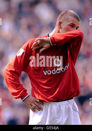 David Beckham von Manchester United, blutbefleckt nach einer Herausforderung mit dem Chelsea-Spieler Greame LeSaux, während ihres FA-Premiership-Spiels in Old Trafford. Stockfoto