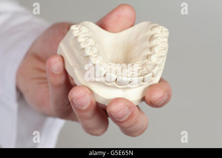 Hand hält ein Gipsmodell des Oberkiefers, Situationsmodell Stockfoto