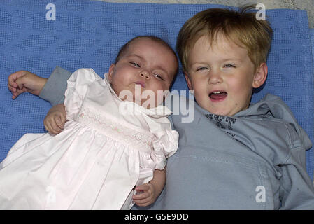 Die siebenmonatige Freya Stratford fotografierte mit ihrem Bruder Adam, 3, im Diana, Princess of Wales Children's Hospital in Birmingham, bevor sie nach einer lebensrettenden Lebertransplantation nach Penrith, Cumbria, nach Hause ging. * Freya war schwer krank mit Gallengang Zustand biliäre Atresie und Ärzte gaben ihr nur Wochen zu leben, es sei denn, ein Spenderorgan gefunden wurde. Im letzten Monat wurde ein Spender gefunden und der Junge wurde einer komplexen achtstündigen Operation unterzogen. Freya, die kurz nach der Operation ihren ersten Zahn geschnitten hat, wird weiterhin genau überwacht, um vor Infektionen zu schützen, aber es wird erwartet, dass sie normal weiterführt Stockfoto