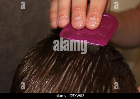 Kopfläuse, Nissen, Behandlung von Nissen, loszuwerden, Kopfläuse ...