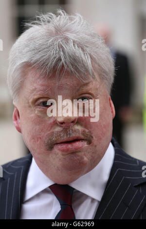 Simon Weston bei der Ankunft in Guildhall für einen Empfang von Freunden und Familie von Baroness Thatcher, veranstaltet von der City of London Corporation, nach ihrem Trauerdienst in St. Paul's Cathedral, im Zentrum von London. Stockfoto