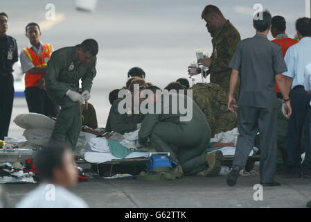 Medizinisches Personal der Royal Australian Air Force bereitet drei balinesische Opfer des Autobombenanschlags des Sari Club auf ihren Flug zum Royal Perth Hospital auf dem Flughafen Denpasar Bali vor. Stockfoto