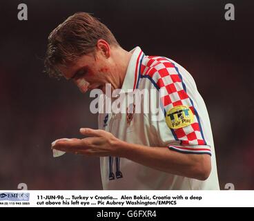 11-JUN-96. Türkei – Kroatien. Alen Boksic, Kroatien mit einem tiefen Schnitt über seinem linken Auge Stockfoto