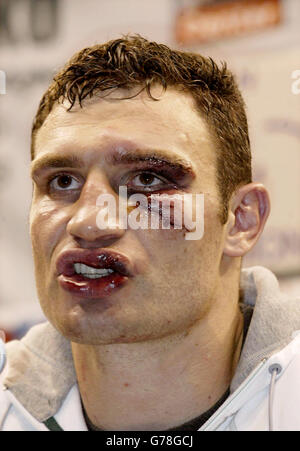 Vitali Klitschko, der von einem Arzt an der Augenbraue und Wange geschlagen und von einem Arzt auf die Wange gestellt wurde, spricht auf der Pressekonferenz in der Staples Center Arena in Los Angeles, nachdem sein Kampf gegen Lennox Lewis am Ende der 6. Runde vom Eckarzt beendet wurde. Lewis behielt seine Titel als WBC und IBO World Heavyweight Boxer. Stockfoto