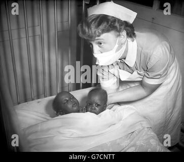 Medizingeräte - siamesische Zwillinge - Hammersmith Hospital, London Stockfoto