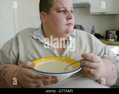 Chris Leppard - Prader-Willi-Syndrom Stockfoto