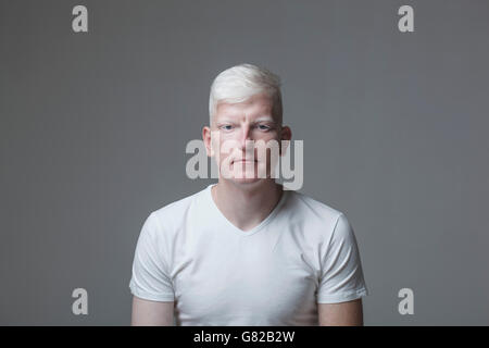 Porträt des jungen Albino Menschen gegen den grauen Hintergrund Stockfoto