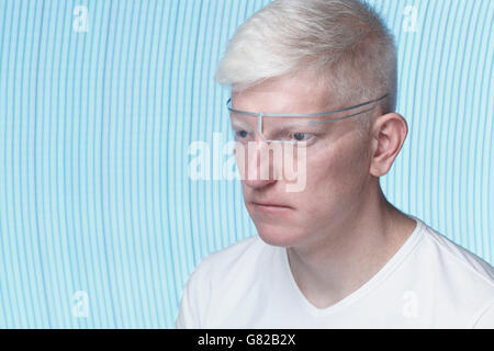 Nahaufnahme des Albino Menschen tragen Schutzbrille vor blauem Hintergrund Stockfoto