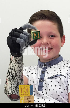 Josh Cathcart, neun, von Dalgety Bay, Fife, der als erster Junge in Großbritannien mit einer kindergroßen bionischen Hand ausgestattet wurde. Stockfoto