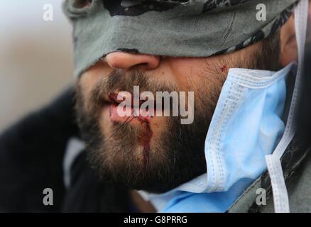 Migranten protestieren, während der Abriss im Flüchtlingslager von Calais, bekannt als Dschungel, in Nordfrankreich weitergeht. Stockfoto