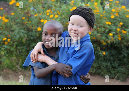 Albino-Mädchen (12 Jahre, rechts) und ein schwarzer Junge (8) in einem Dorf in Ruanda, Afrika Stockfoto