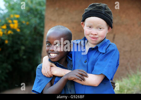 Albino-Mädchen (12 Jahre, rechts) und ein schwarzer Junge (8) in einem Dorf in Ruanda, Afrika Stockfoto