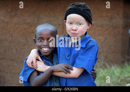 Albino-Mädchen (12 Jahre, rechts) und ein schwarzer Junge (8) in einem Dorf in Ruanda, Afrika Stockfoto